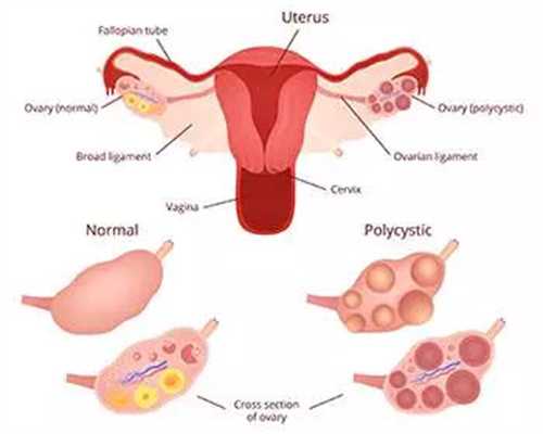 卵巢早衰会影响供卵试管吗卵巢早衰会影响供卵试管吗？了解女性卵巢早衰对试